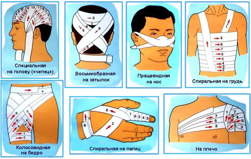 Перевязки