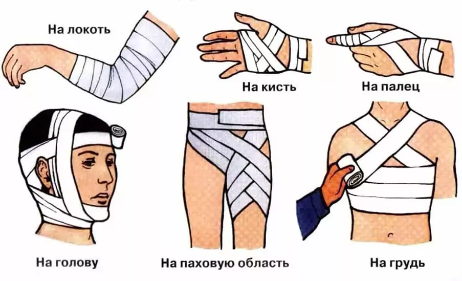 Перевязки