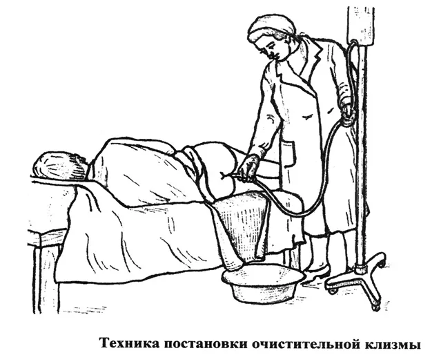 Как проводится процедура постановки клизмы