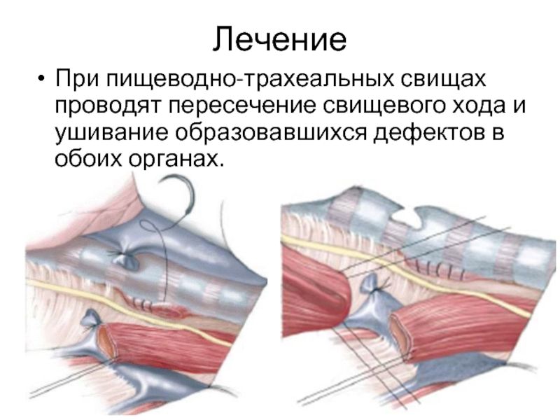 Статья 2 (3)